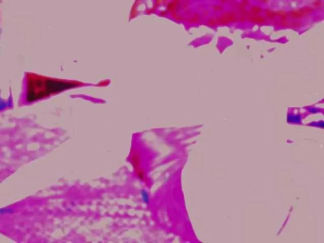 Avatar of LollyGirlMoon